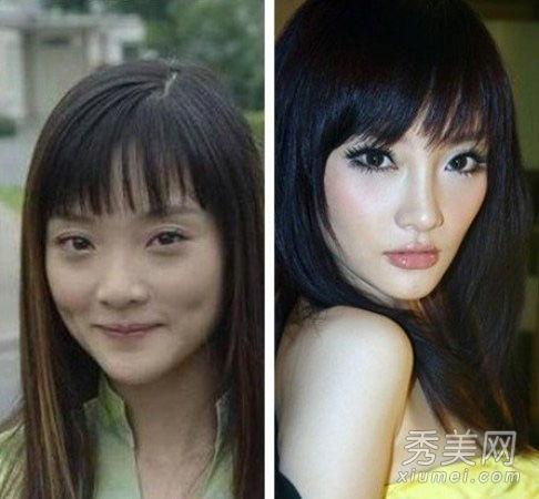 明星爆料整容视频大全下载,视频大全下载解析  第3张